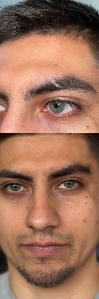 person tattoo on Face by William_Samaras on TattMe