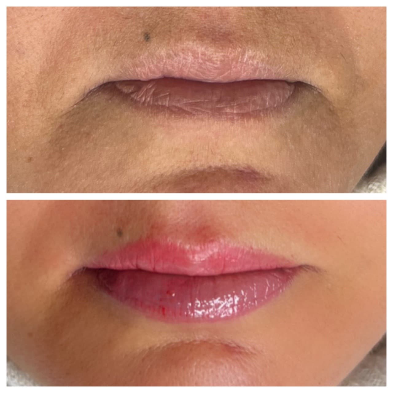Cosmetic Tattoos + Color lips tattoo on Face by Versa_PMU on TattMe