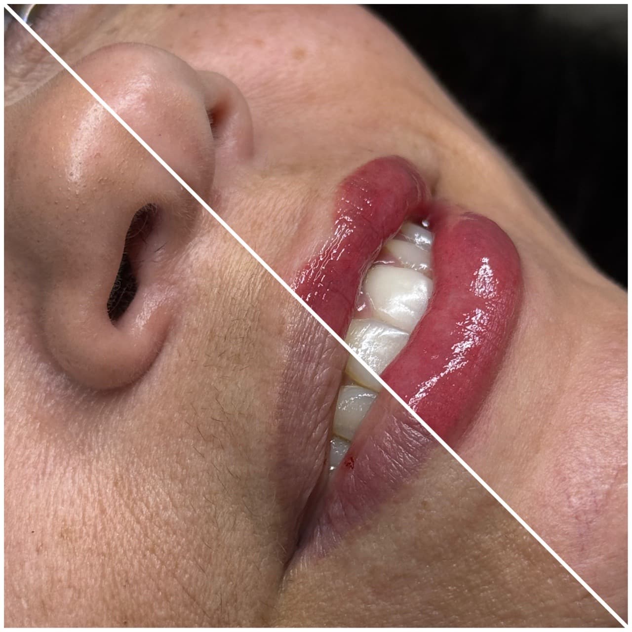 Cosmetic Tattoos lips tattoo on Face by Versa_PMU on TattMe