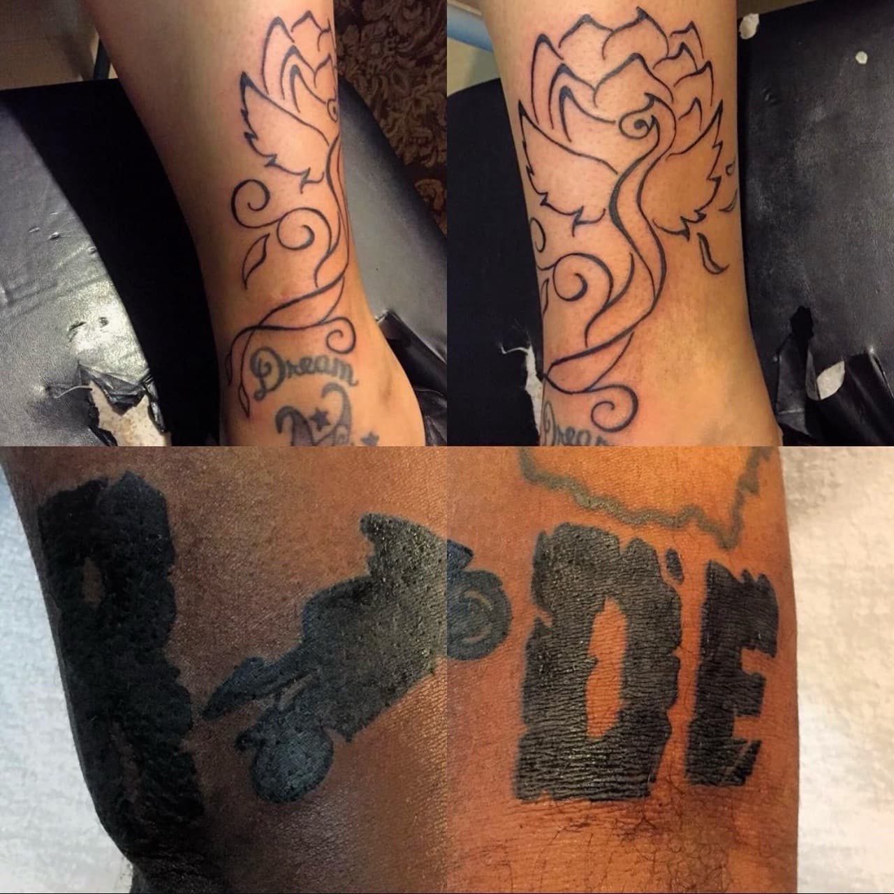 Fine Line + Black-work flower tattoo on Ankle by Art_by_Prynce on TattMe