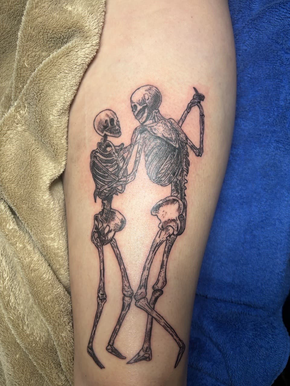Line-work + Black-work skeletons tattoo on Thigh by Eternal_Ink_Tatz on TattMe
